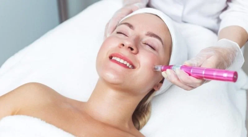 Tratamiento Microneedling (Dermapen) en Maradia Estética, Buenos Aires